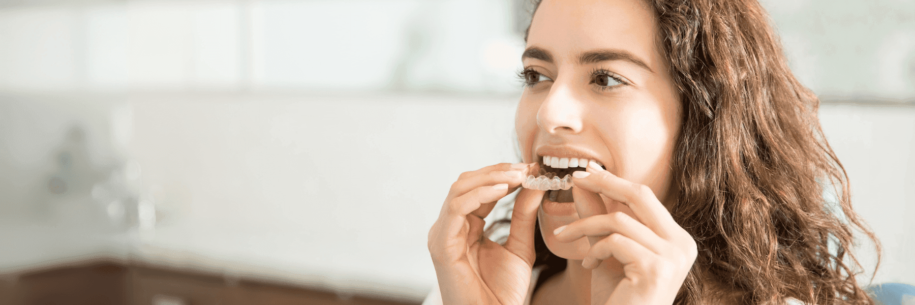 Clear Aligners | Dentist