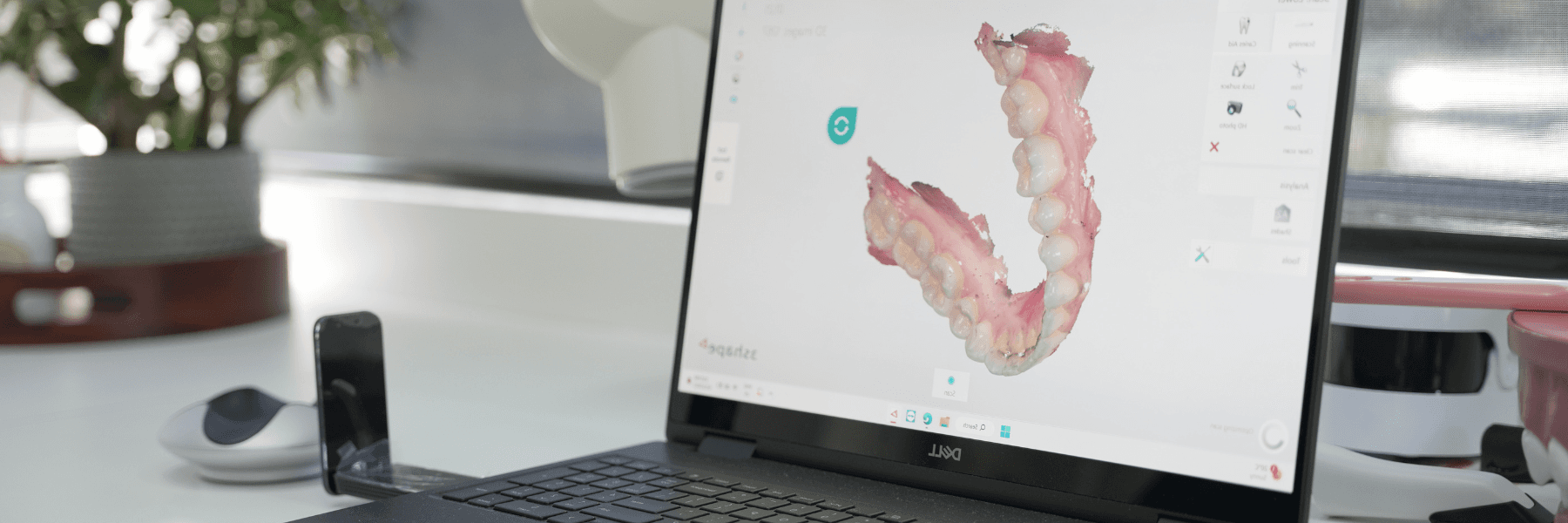 Dentures & Partials | Dentist
